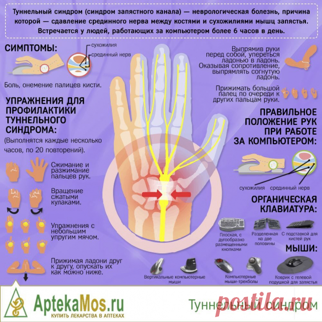 Туннельный синдром