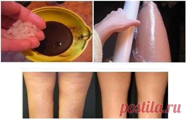 Курс из 5 обертываний убирает несколько сантиметров с талии и бедер! | Женский журнал