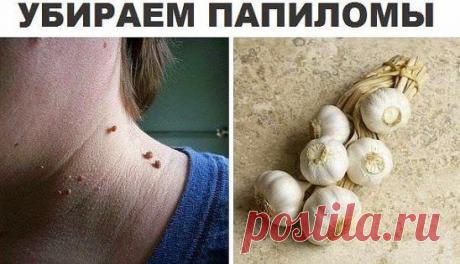 (62) Одноклассники