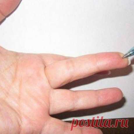 Особая точка на пальце, которую используют в военной медицине - МирТесен
