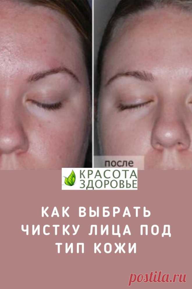 Как выбрать чистку лица под тип кожи. Подробная Инструкция. Если вы хотите иметь идеально гладкую кожу, то регулярных походов на чистку не избежать. Мы решили составить подробный гид, чтобы вы могли сами выбрать подходящий вид чистки лица под свой тип кожи или проблемы.
 Кликайте на фото, чтобы прочитать ⤴