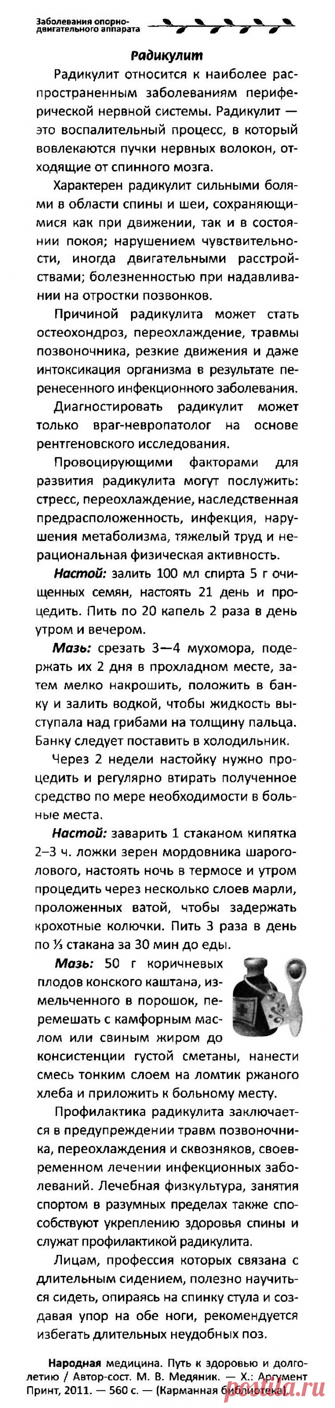 Радикулит