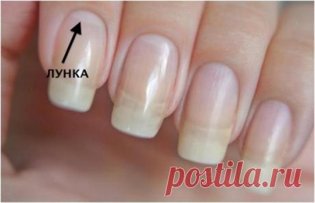 БЕЛЫЕ ЛУНКИ.НЕ ПРОПУСТИ ТРЕВОЖНЫЙ СИМПТОМ!
Взгляни на свои ногти: видишь светлые полумесяцы у их основания? Это и есть лунки или лунулы.
Как правило большинства людей они имеются от рождения, а вот с возрастом могут исчезнуть на некоторых пальцах совсем, а на некоторых поблекнуть… Оказывается, состояние лунки того или иного ногтя может указывать на состояние определенных органов!
Лунки на ногтях
Официальная медицина допускает возможность диагностики заболеваний по состояни...