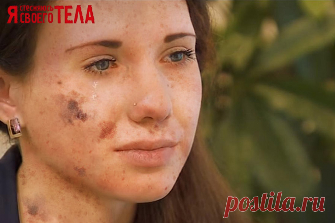 Я стесняюсь своего тела