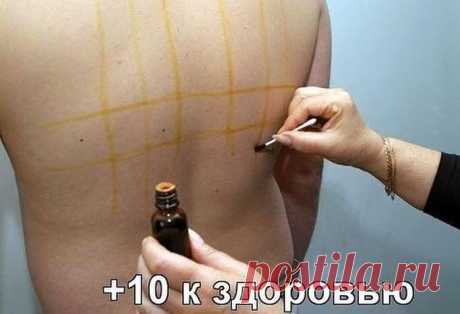 йодовая сетка!!!!