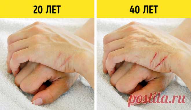10 неожиданных признаков старения, которые выдают ваш возраст раньше любых морщин