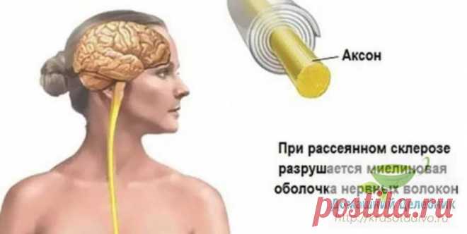 Народные средства для улучшения мозгового кровообращения: скажи «нет» слабоумию, рассеянности и немощи Гипертония и атеросклероз — две основные причины, приводящие к нарушению мозгового кровообращения.

Именно из-за них развивается паралич, падает зрение, теряется координация, нарушается движение, возн…