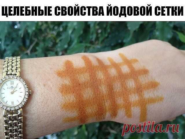 Йодовая сетка: целебные свойства простых линий

Конструктор здоровья.

Можно насчитать не менее двадцати различных заболеваний, при которых облегчить состояние человека можно путем наложения йодовой сетки. Крошечная склянка с йодом обычно имеется в каждой домашней аптечке – ведь никто в повседневной жизни не застрахован от ран и порезов, требующих оперативной антисептической обработки. Еще в XIX веке врачи обнаружили, что при контакте с кожей йодный раствор способен действ...