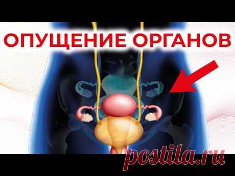 Опущение внутренних органов. Висцероптоз.
