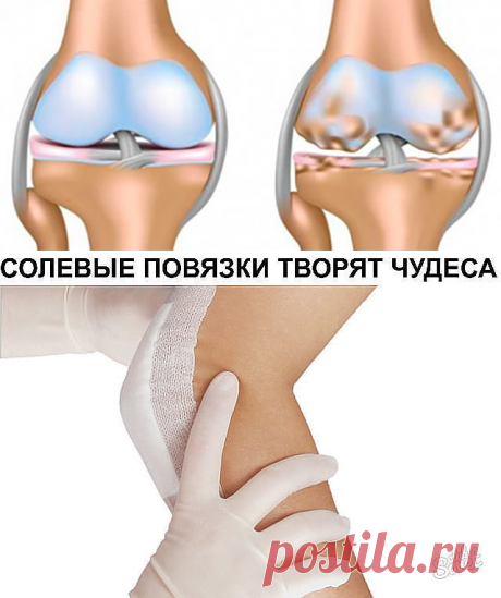 Это скрывали все хирурги! Так лечатся суставы дома за сутки