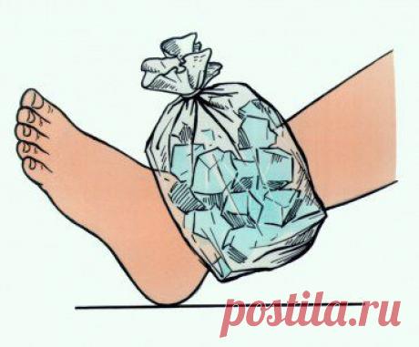 Ушибы, растяжения, разрывы и вывихи. Они похожи – но все равно очень разные