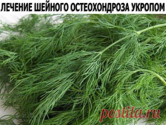ЛЕЧЕНИЕ ШЕЙНОГО ОСТЕОХОНДРОЗА УКРОПОМ.
Настоять 200 г семян укропа на 250 мл водки 2 недели. Принимать по 1 ст. л. З раза в день перед едой. Мы настаивали 400 г семян укропа на 500 мл спирта, разведенного пополам. Готовили такую порцию 3 раза. И муж выздоровел. Болезнь не возвращалась на протяжении дальнейшей его жизни. Прожил он до 86 лет, а болел в возрасте 59-60 лет. Работал до 74 лет. В любую погоду ходил - грудь нараспашку, и шарф не носил. Вот два случая выздоровления. Надеюсь, рецепт еще