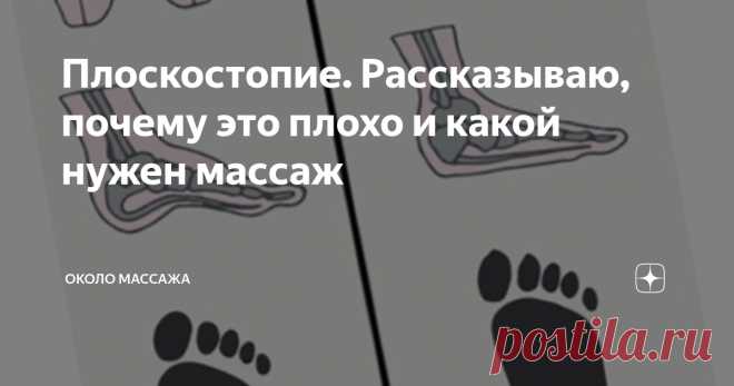 Плоскостопие. Рассказываю, почему это плохо и какой нужен массаж Спасать надо спину, а не ноги и вот почему...
Плоскостопие подразделяют на
Подробно о плоскостопии можно почитать ЗДЕСЬ.