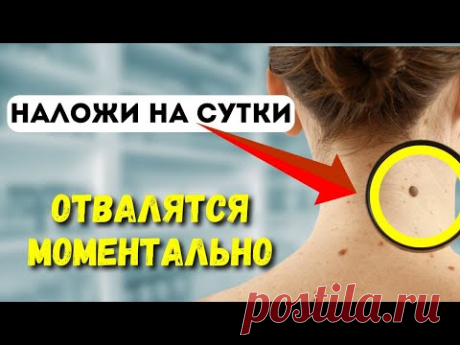 Папилломы отпадут 1000%.Самый простой и дешевый  способ удаления висячих родинок в домашних условиях