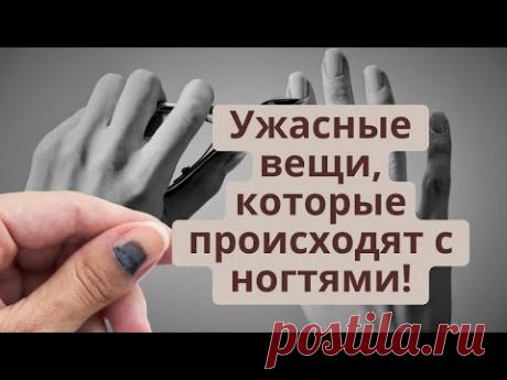 Ужасные вещи, которые происходят с ногтями!