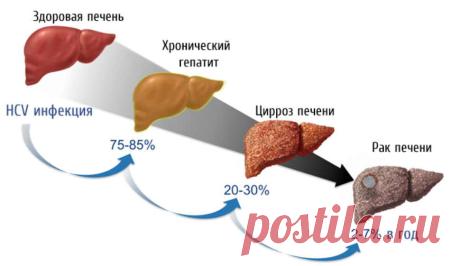 Лечение болезней печени и желчного пузыря зверобоем. Трава. которая способна заменить больницу - читаем и применяем!