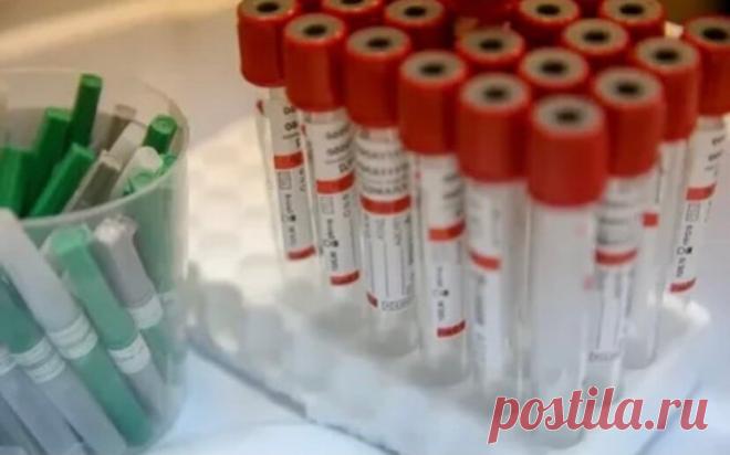 Почему сейчас не проверяют антитела перед вакцинацией
Как известно, если переболеть в детстве одной из детских инфекций (ветрянка, краснуха, корь и др.), то образовавшиеся антитела обычно сохраняются в течение жизни, что защищает …
Читай дальше на сайте. Жми подробнее ➡