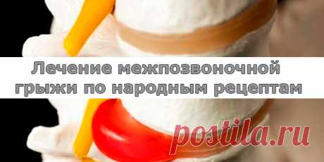 Лечение межпозвоночной грыжи по народным рецептам | Полезные советы