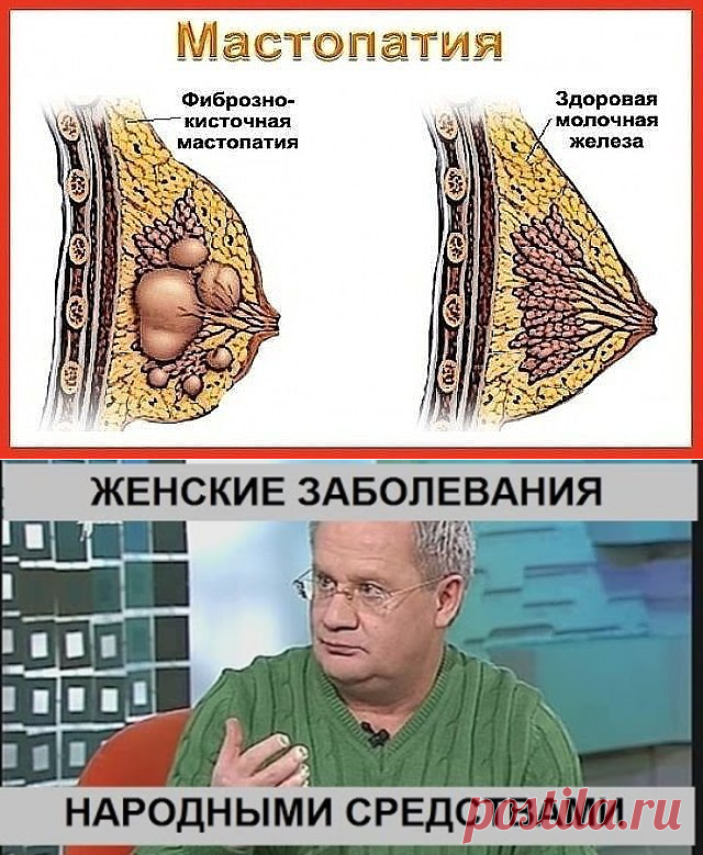 (4) Одноклассники