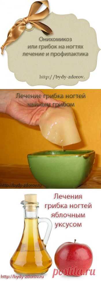 Грибок на ногтях, вылечим | Народные способы лечение грибка