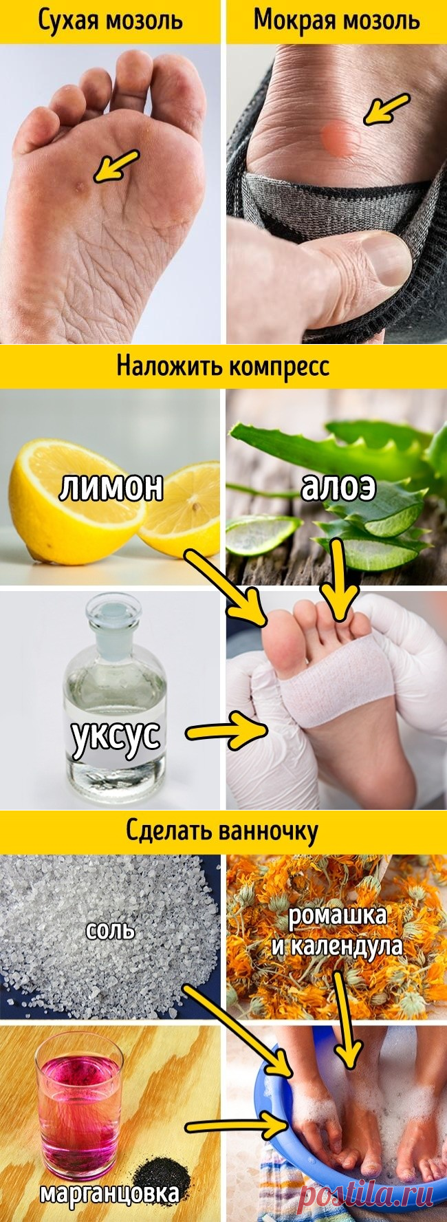 11 легких способов вылечить мозоль от неудобной обуви