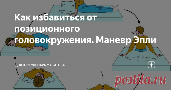 Как избавиться от позиционного головокружения. Маневр Эпли Недавно я пообещала вам подробнее рассказать ещё об одном виде головокружения. Проблема может возникать из-за перемещения отолитов. Разберёмся.