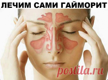 (2) Одноклассники