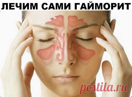 (2) Одноклассники