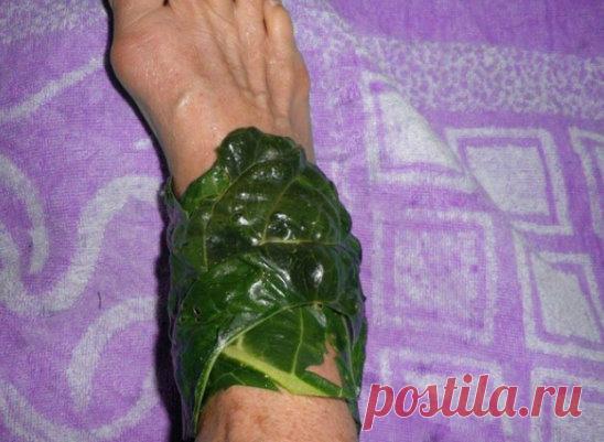 ЛЕЧЕНИЕ СУСТАВОВ КАПУСТНЫМ ЛИСТОМ 
Возьмите капустный лист, сделайте на нем небольшие засечки. 
Нагрейте над плитой или в микроволновой печи и намажьте тонким слоем меда. 
Приложите капустно-медовый компресс к пораженному суставу, сверху положите целлофан, закрепите бинтом и укутайте теплым платком или шарфом. 
Подобные компрессы желательно делать на ночь, уже после нескольких применений вы забудете о боли в коленях. 
Рекомендуемый курс лечения – 1 месяц. 
Даже если у вас нет меда, то эффект