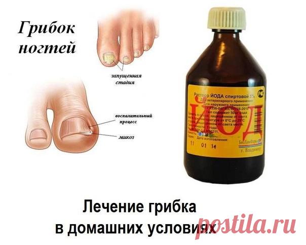 ЛЕЧИМСЯ ДОМА...

ГРИБОК — успешное лечение народными средствами...

ГРИБОК НА НОГТЯХ РУК. Сварите крепкий кофе и несколько раз погрузите руки в его настой, но осадок не взбалтывайте. Это средство лечит также грибок на ногах, снимает боли в ступнях и лодыжках, помогает избавиться от толстой отслаивающейся кожи на пятках. При повторении процедуры несколько вечеров подряд грибок полностью исчезает, кожа становится гладкой, а боли проходят.

 ГРИБОК НА ПАЛЬЦАХ НОГ. Хорошо вымы...