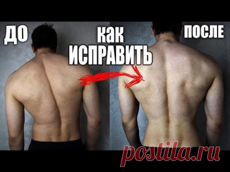Как Исправить Осанку (Сколиоз Позвоночника!!)