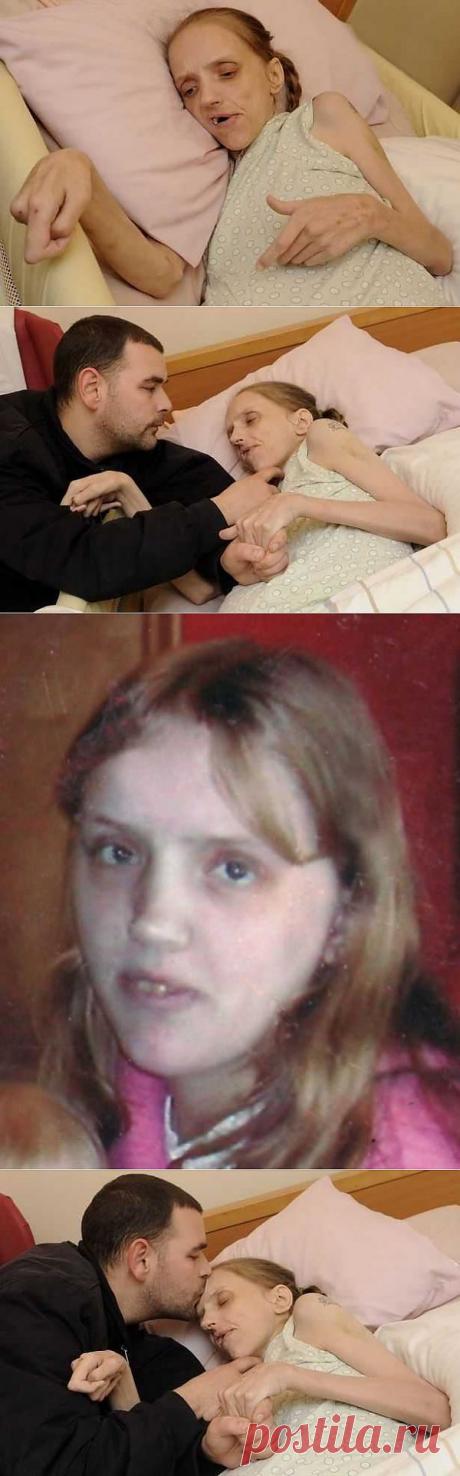 Что с женщиной может сделать любовь к алкоголю. Шокирующие снимки | Новости медицины и здоровья на Обозревателе