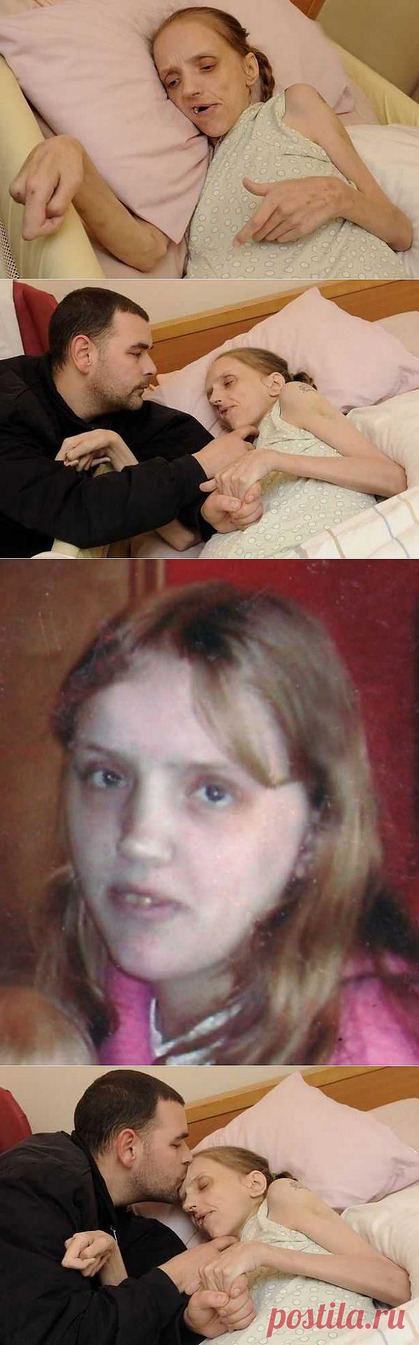 Что с женщиной может сделать любовь к алкоголю. Шокирующие снимки | Новости медицины и здоровья на Обозревателе