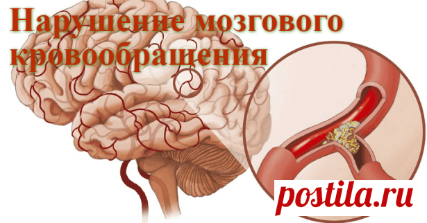 Лекарственные растения при нарушении мозгового кровообращения | Советы целительницы