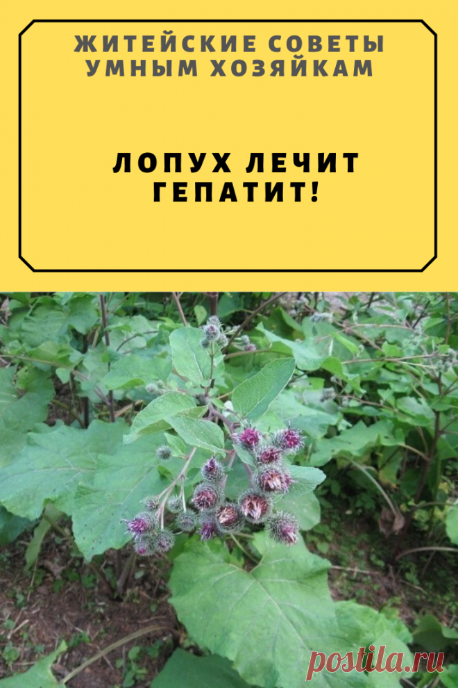 Лопух лечит гепатит! | Житейские Советы