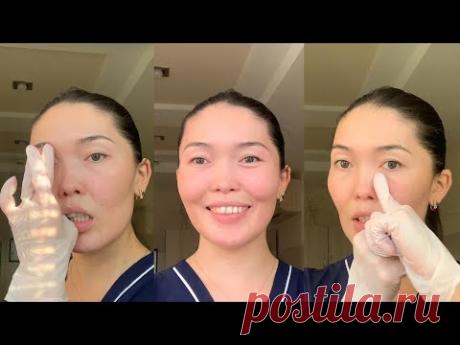 Убери отеки и морщины за 10 минут. Буккальный Самомассаж от Айгерим Жумадиловой [СО ЗВУКОМ]