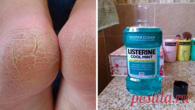 Удивительные способы использование Listerine, о которых должна знать каждая женщина — informed news 24