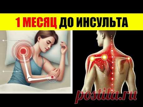 7 Тихих Признаков За 1 Месяц До Инсульта