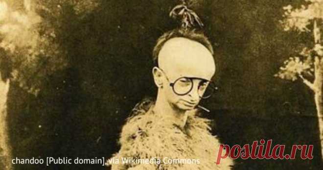 Девушка-птица: как сложилась судьба спасенной из психбольницы циркачки с необычной внешностью | Краше Всех