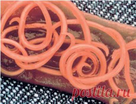 Гельминтозы | Арго в Минске