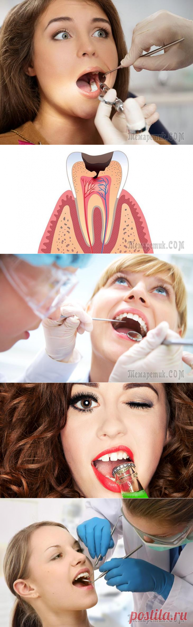 Кариес может быть обращен вспять, или Что Вы не знали о зубах