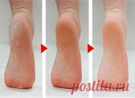 (60) Одноклассники