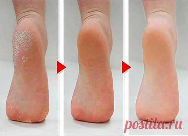 (60) Одноклассники