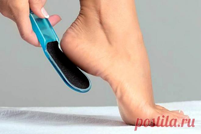 3 способа удалить твердую кожу с пяточек в домашних условиях
