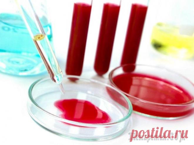 Холестерин ЛПНП — что это значит, нормы, когда повышен и понижен В статье говорим о холестерине ЛПНП. Обсуждаем причины его повышения. Вы узнаете, какие заболевания вызывают отложения жирного спирта, и как снизить уровень соединения в домашних условиях.Что это тако...