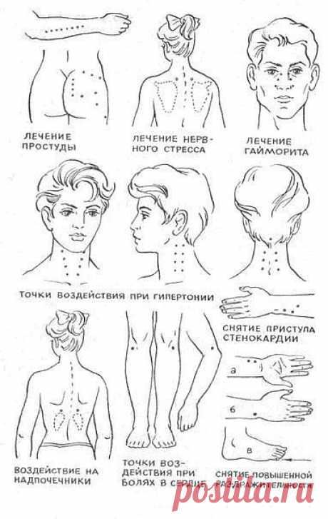 Cнятие боли,нажимая на точки тела.