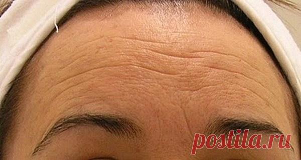 Избавьтесь от морщин всего за семь дней! Сделайте самодельный крем, который сделает вас моложе Натуральный и эффективный!