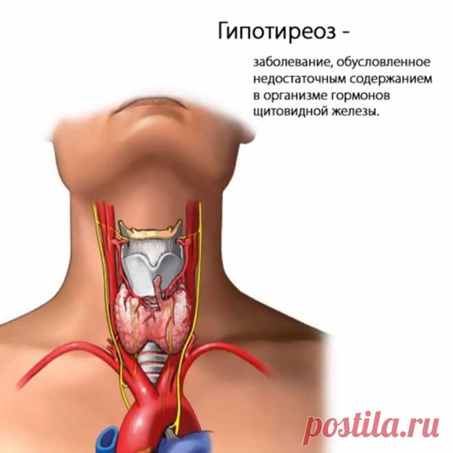 Гипотиреоз: продукты питания, ускоряющие метаболизм Продукты, стимулирующие обмен веществГипотиреоз — расстройство функций щитовидной железы, в результате которого этот орган ослабевает и начинает вырабатывать меньшее количество гормонов.
Это заболеван…