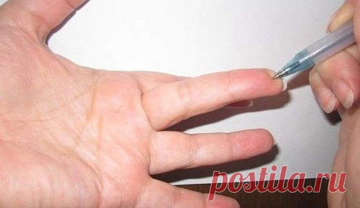 Стоит нажать эту точку на пальце, и боль отступит.