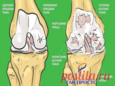 Принимаю желатин для здоровья суставов, красоты кожи и волос. Довольна результатом!